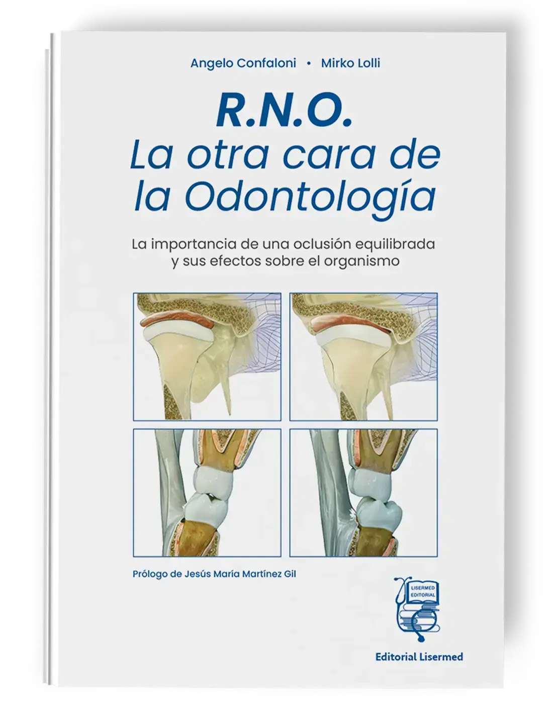 RNO-CONFALONI